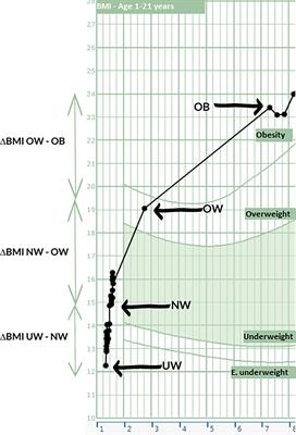 Transition From Diencephalic Syndrome to Hypothalamic Obesity in Children With Suprasellar Low Grade Glioma: A Case Series